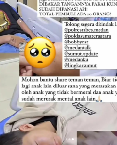 VIRAL! Siswa MAN 1 Medan Korban Bully yang Dipaksa Makan Lumpur Hingga Tangannya Disundut Besi Panas