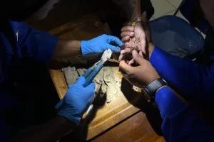 Unik, Mata Gerinda Tersangkut di Jari Manis Seorang Gadis, Petugas Damkar Turun Tangan