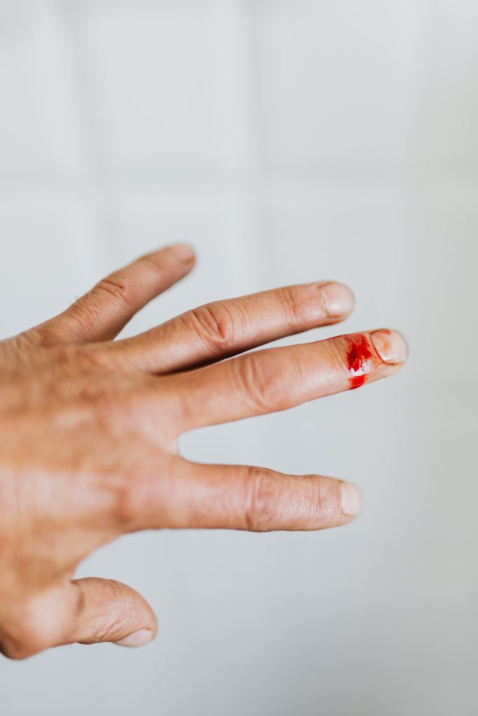 Kumpulan Arti Mimpi Darah Menurut Primbon Jawa, Sudah Saatnya Keluar Dari Zona Nyaman! 