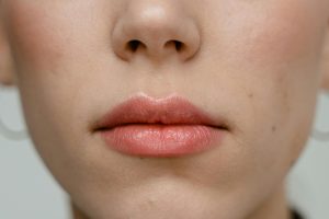 5 Cara Mengatasi Bibir Kering Lengkap dengan Solusi Paling Ampuh, Bye-bye Bibir Pecah