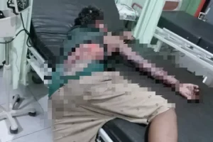 Korban Ledakan Petasan di Ponorogo Dirawat Intensifdi RSUD dr Harjono Ponorogo, Begini Kondisinya