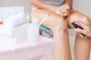 Bakteri “Pemakan Daging” Merebak di Jepang, Kemenkes Pastikan Belum Ada Kasus di Indonesia