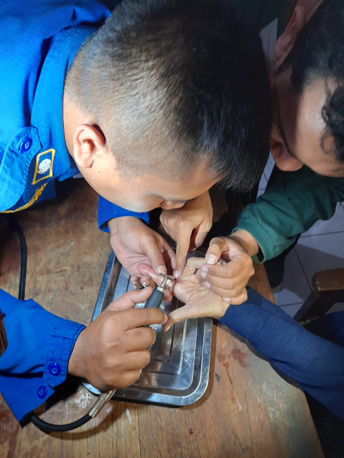 Mbah Saini, Nenek Lanjut Usia Minta Tolong Damkar Kabupaten Kediri, Jari Tangannya Melepuh Akibat Cincin