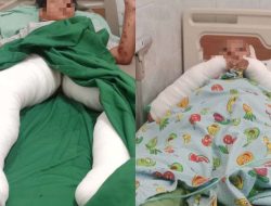 Polisi Periksa Saksi dan Rekaman CCTV Terkait Ledakan Petasan di Malang