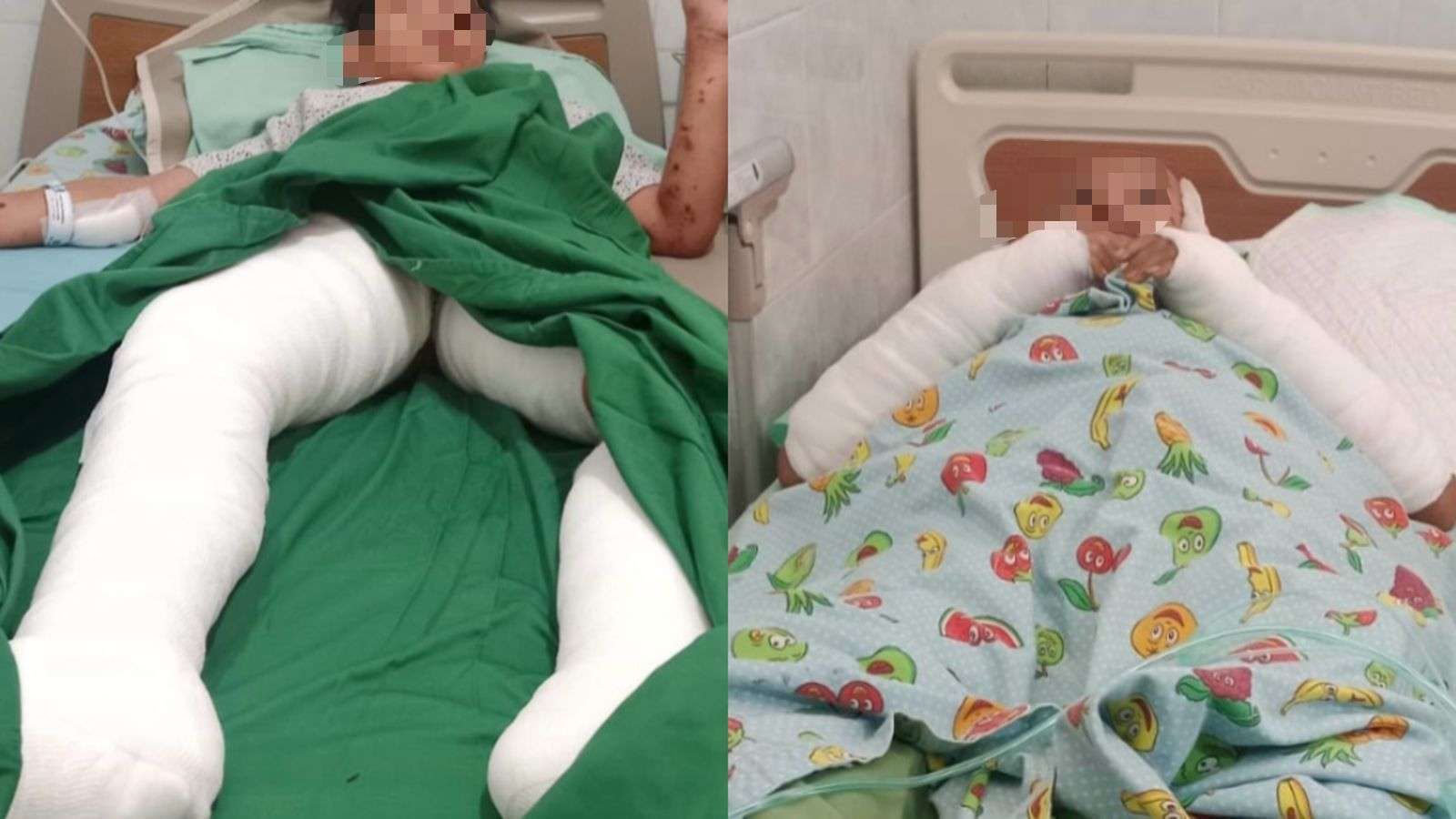 Polisi Periksa Saksi dan Rekaman CCTV Terkait Ledakan Petasan di Malang