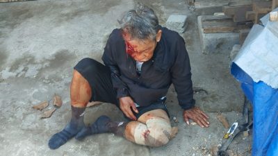 Kecelakaan Truk dan Motor di Simpang PG Pesantren, Satu Pengendara Luka Wajah