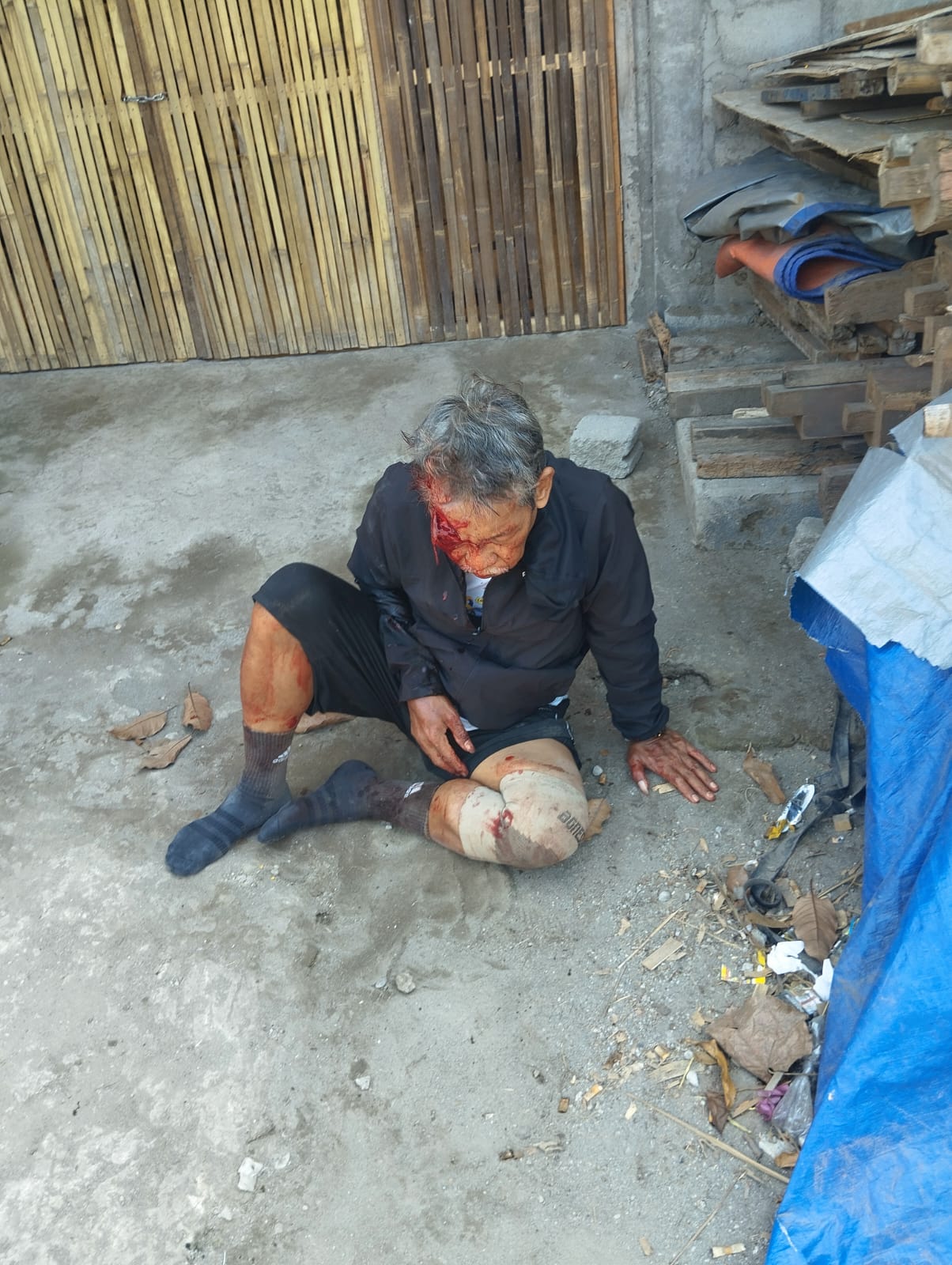 Kecelakaan Truk dan Motor di Simpang PG Pesantren, Satu Pengendara Luka Wajah