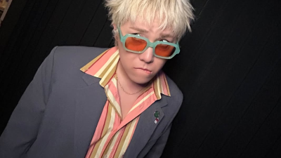 Lee Hong Ki FT Island Bongkar Derita Penyakit Kulit Langka Selama 20 Tahun