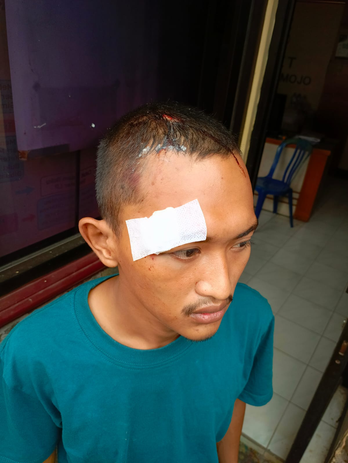 Pamit Cari Makan, Dua Pemuda Mojo Jadi Korban Pengeroyokan di Jalan Raya