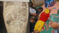 5 Fakta di Balik Kematian Raya, Bocah Cacingan Asal Sukabumi