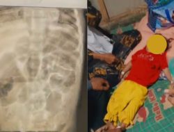 5 Fakta di Balik Kematian Raya, Bocah Cacingan Asal Sukabumi