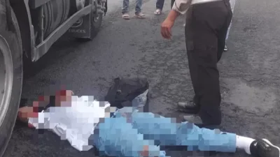 Pelajar di Lamongan Terlindas Truk Trailer Saat Berangkat Sekolah, Alami Patah Tulang