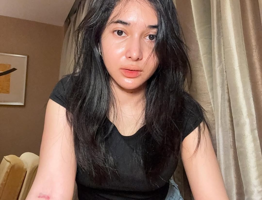 Aduh! Dilan Janiyar Bikin Praz Teguh Salting Saat Blak-blakan Soal Operasi Payudara 
