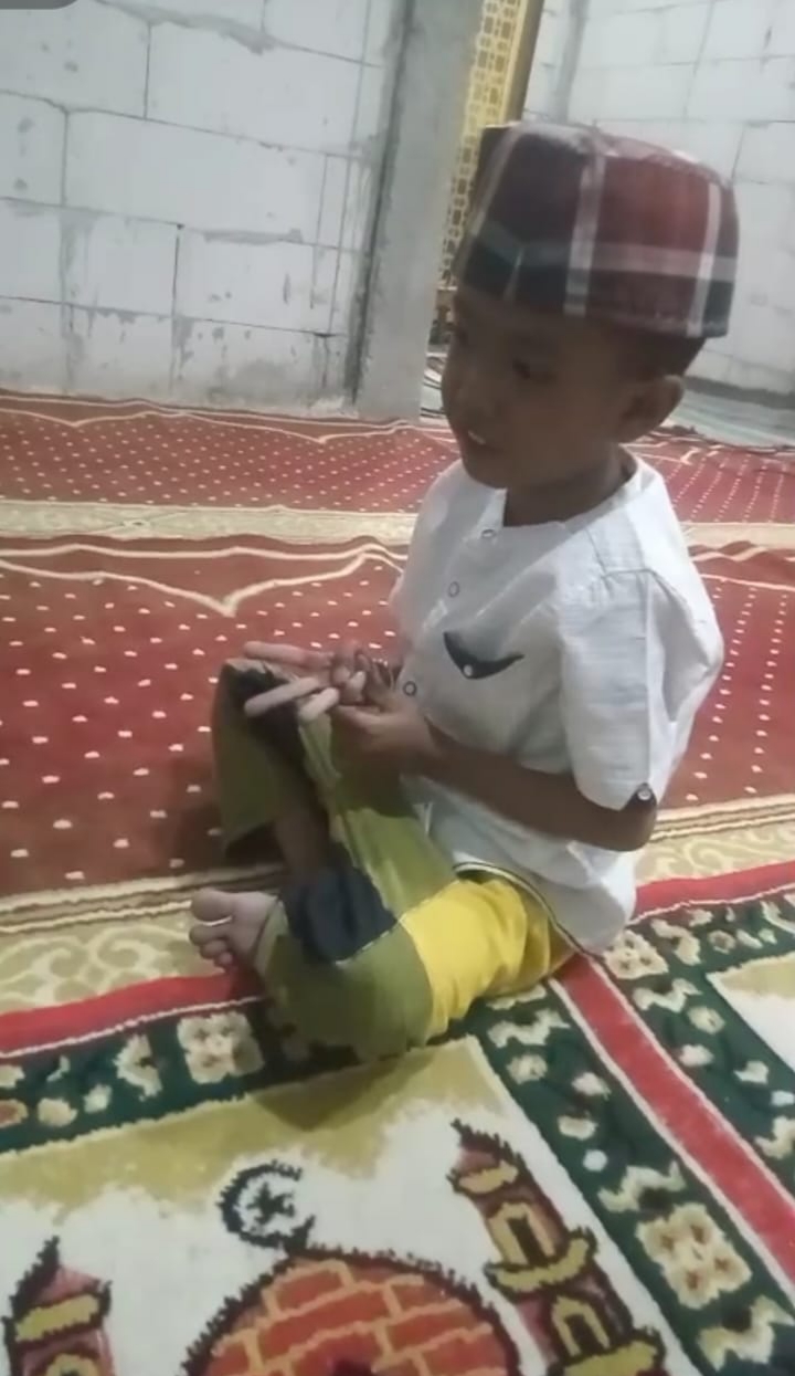 Bocah 7 Tahun di Jombang Derita Stunting dan Bocor Jantung, Perlu Uluran Tangan Pemerintah