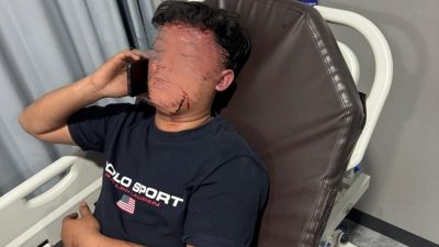 Kericuhan di Acara Musik Underground Batu, Dua Pemuda Malang Jadi Korban Pembacokan