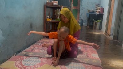 Bocah Asal Jombang Butuh Uluran Tangan, 10 Tahun Mengalami Lumpuh