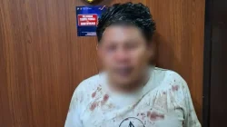 Cekcok di Hajatan Berujung Sabetan Celurit