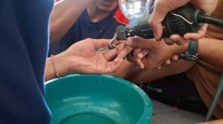Jari Manis Bocah 6 Tahun di Lamongan Terjepit Grendel Jendela, Dievakuasi Damkar