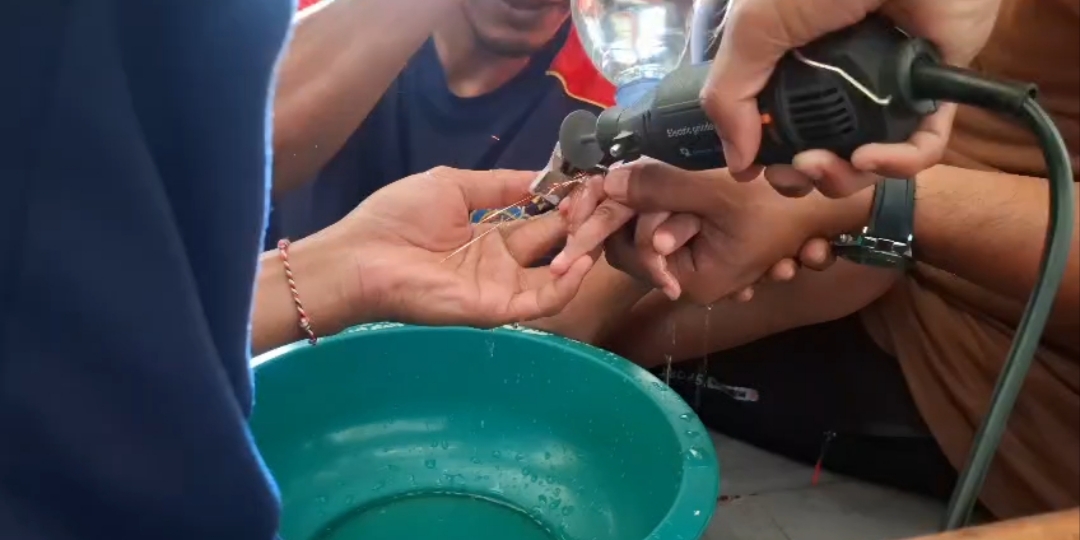 Jari Manis Bocah 6 Tahun di Lamongan Terjepit Grendel Jendela, Dievakuasi Damkar