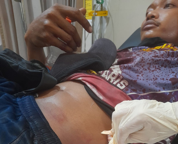 Gegara Persoalan Cincin Tunangan, Pria di Lamongan Ditusuk hingga Bersimbah Darah